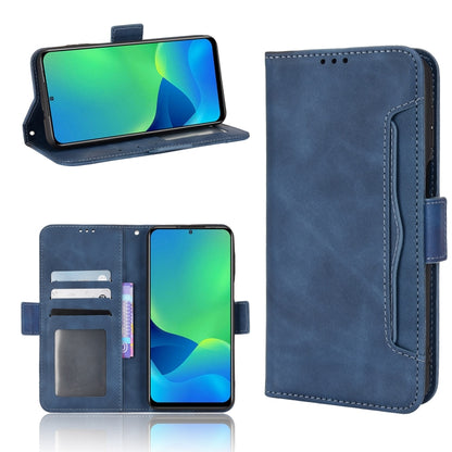 For Ulefone Note 13P Skin Feel Calf Pattern Leather Phone Case(Blue) - Ulefone Cases by PMC Jewellery | Online Shopping South Africa | PMC Jewellery | Buy Now Pay Later Mobicred