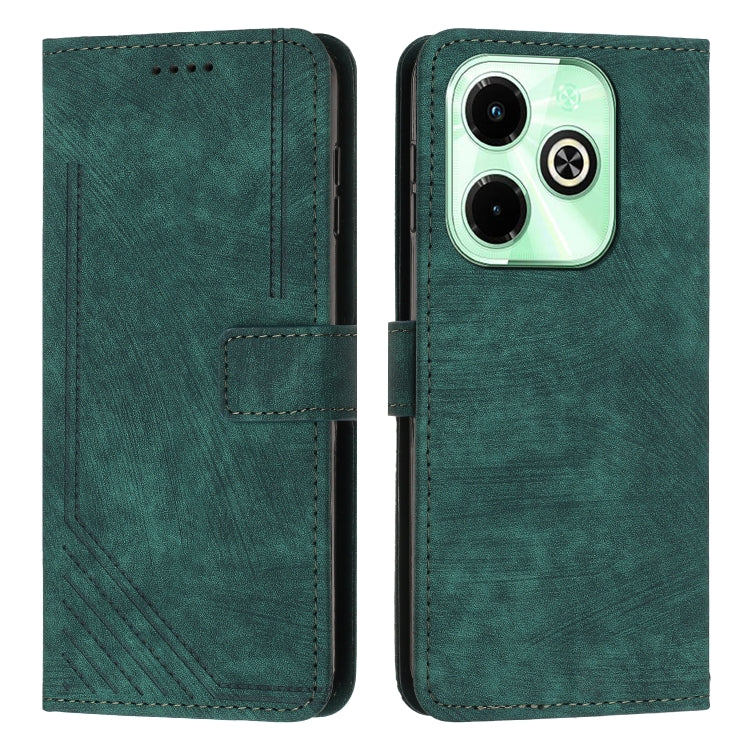 For Infinix Hot 40i Skin Feel Stripe Pattern Leather Phone Case with Lanyard(Green) - Infinix Cases by PMC TechLife | Online Shopping South Africa | PMC TechLife | Buy Now Pay Later Mobicred