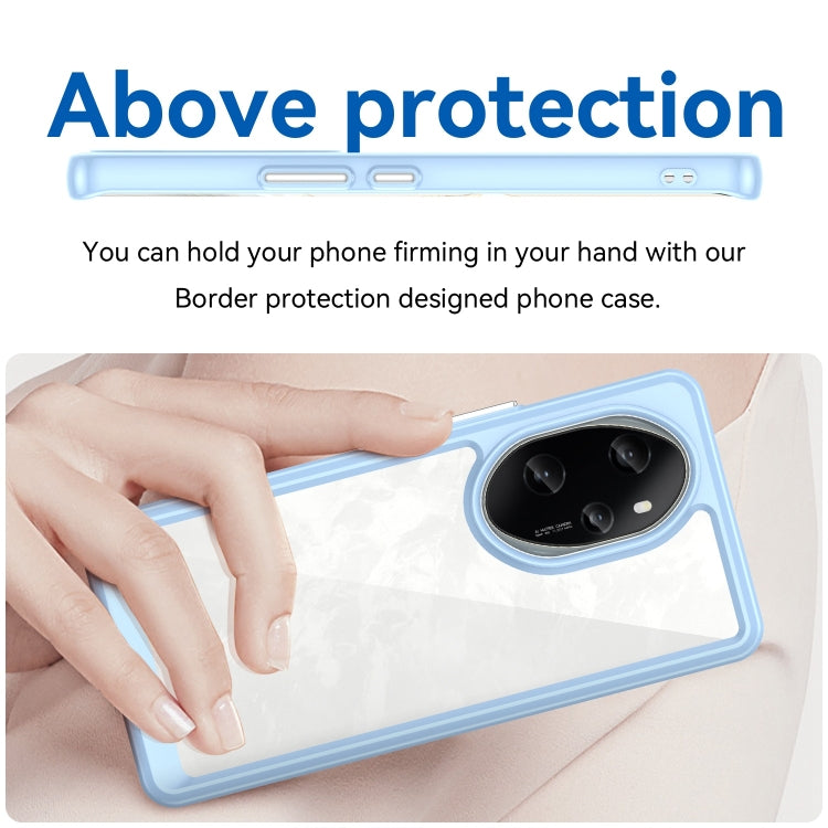 For Honor 100 Pro Colorful Series Acrylic Hybrid TPU Phone Case(Blue) - Honor Cases by PMC TechLife | Online Shopping South Africa | PMC TechLife | Buy Now Pay Later Mobicred