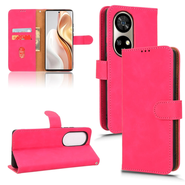 For Ulefone Note 17 Pro Skin Feel Magnetic Flip Leather Phone Case(Rose Red) - Ulefone Cases by PMC Jewellery | Online Shopping South Africa | PMC Jewellery | Buy Now Pay Later Mobicred