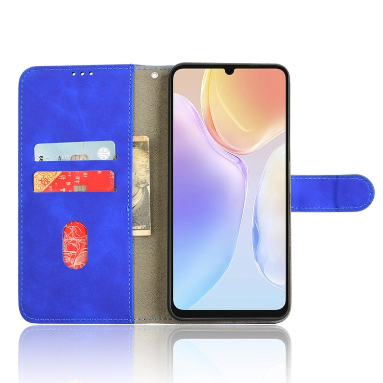 For Ulefone Note 20 Pro Skin Feel Magnetic Flip Leather Phone Case(Blue) - Ulefone Cases by PMC Jewellery | Online Shopping South Africa | PMC Jewellery | Buy Now Pay Later Mobicred