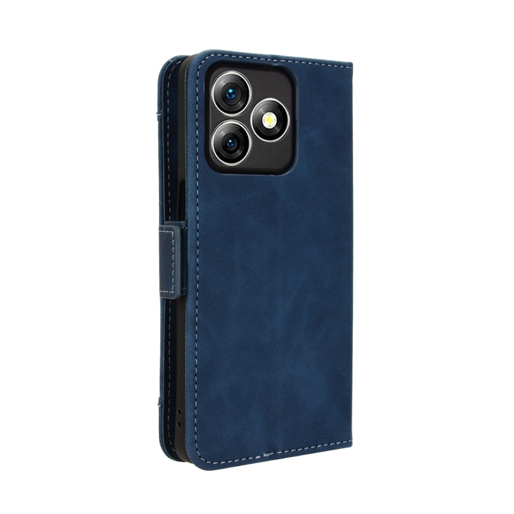 For Ulefone Note 18 Ultra Skin Feel Calf Texture Card Slots Leather Phone Case(Blue) - Ulefone Cases by PMC Jewellery | Online Shopping South Africa | PMC Jewellery | Buy Now Pay Later Mobicred