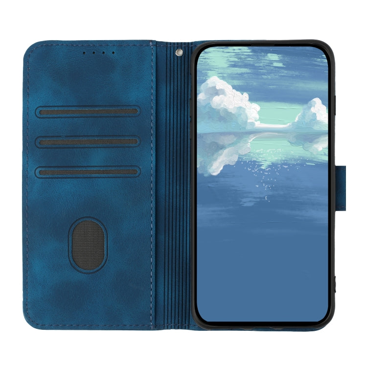 For Honor Magic5 Lite 5G Line Pattern Skin Feel Leather Phone Case(Royal Blue) - free shipping - PMC TechLife - Order now!